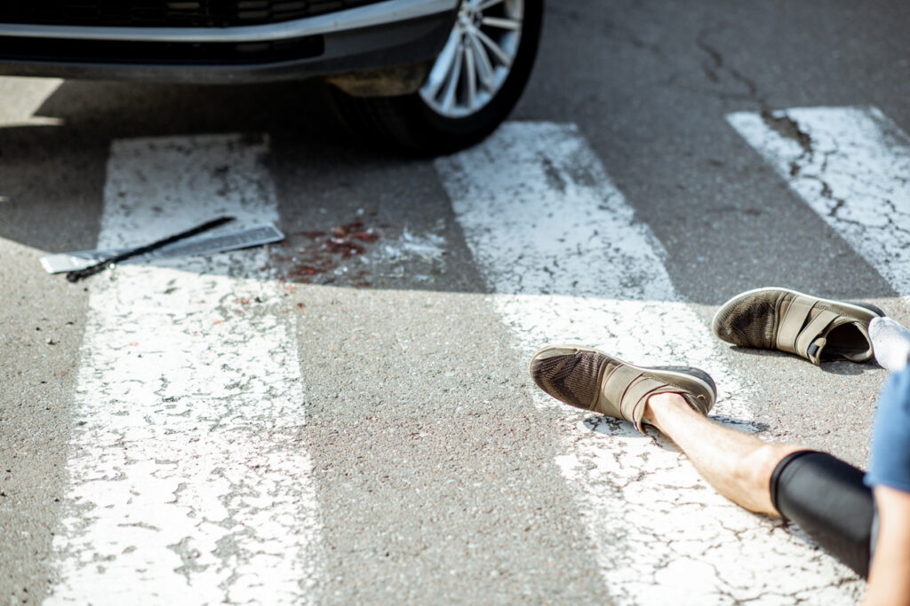 Pedestrian lying injured on crosswalk after a collision in Irvine, CA